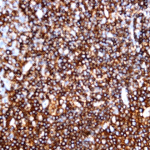 CD5 Antibody in Immunohistochemistry (Paraffin) (IHC (P))