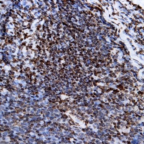 CD95 Antibody in Immunohistochemistry (Paraffin) (IHC (P))