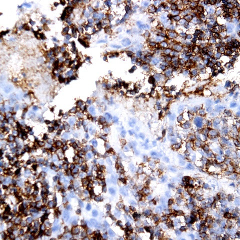 p27/Kip Antibody in Immunohistochemistry (Paraffin) (IHC (P))