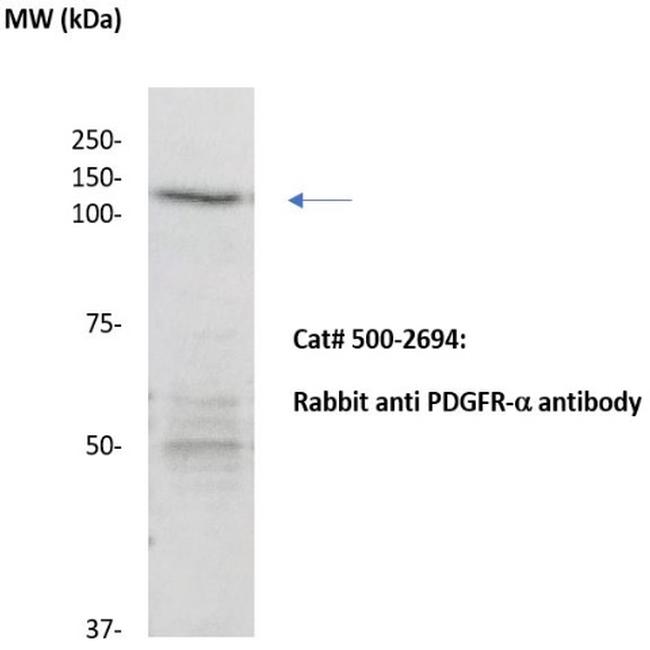 PDGFR-alpha Antibody in Western Blot (WB)