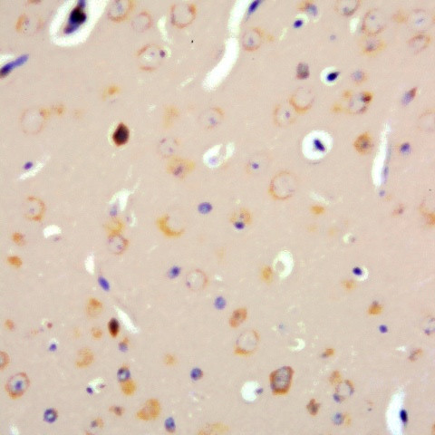 Parathyroid Hormone (PTH) Antibody in Immunohistochemistry (Paraffin) (IHC (P))