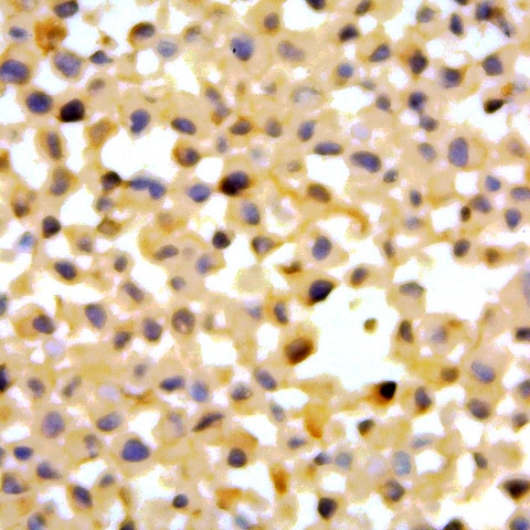 Cathepsin D Antibody in Immunocytochemistry (ICC/IF)