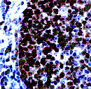 PCNA Antibody in Immunohistochemistry (Paraffin) (IHC (P))