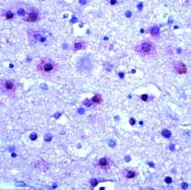 mGluR5 Antibody in Immunohistochemistry (Paraffin) (IHC (P))