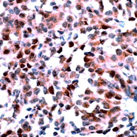 mGluR1 Antibody in Immunohistochemistry (Paraffin) (IHC (P))