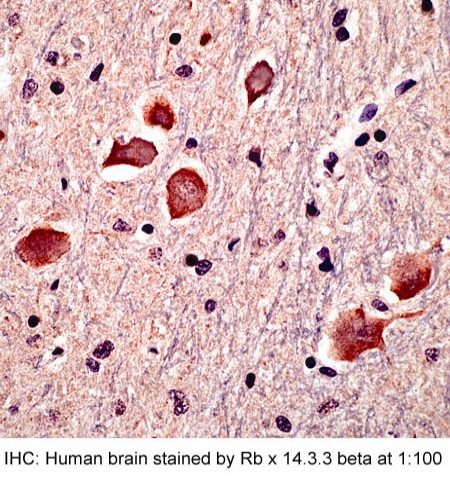 14-3-3 beta Antibody in Immunohistochemistry (Paraffin) (IHC (P))