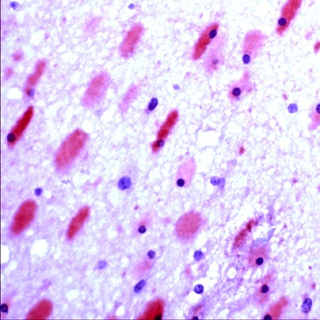 GluR6/7 Antibody in Immunohistochemistry (Paraffin) (IHC (P))
