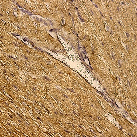 Myoglobin Antibody in Immunohistochemistry (Paraffin) (IHC (P))