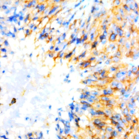 GluR 2/3 Antibody in Immunohistochemistry (Paraffin) (IHC (P))