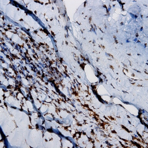 CD23 Antibody in Immunohistochemistry (Paraffin) (IHC (P))
