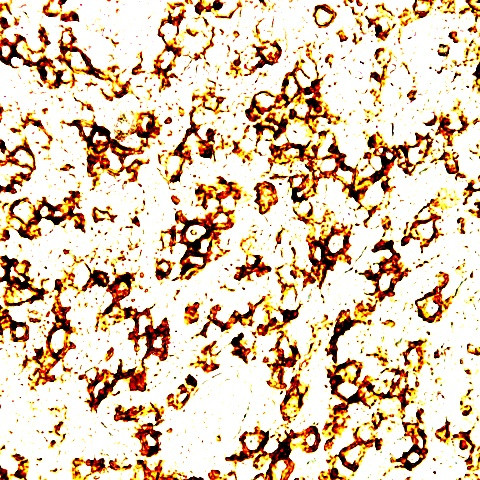 CD2 Antibody in Immunohistochemistry (Paraffin) (IHC (P))