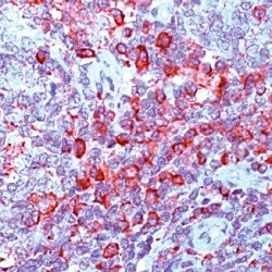 CD3 zeta Antibody in Immunohistochemistry (Paraffin) (IHC (P))