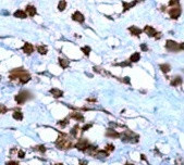 GluR1 Antibody in Immunohistochemistry (Paraffin) (IHC (P))