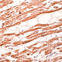 Troponin T Antibody in Immunohistochemistry (Paraffin) (IHC (P))