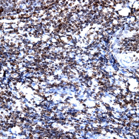 CD38 Antibody in Immunohistochemistry (Paraffin) (IHC (P))