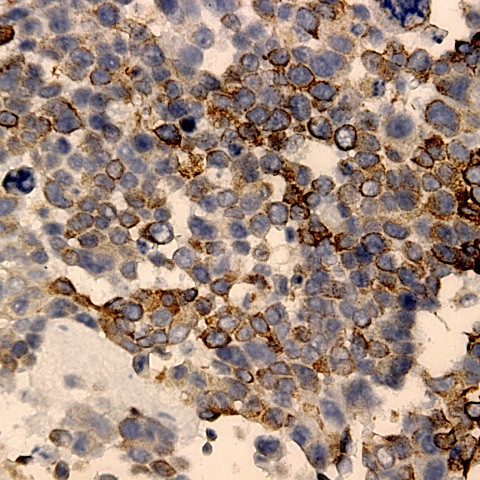GLUT-3 Antibody in Immunohistochemistry (Paraffin) (IHC (P))