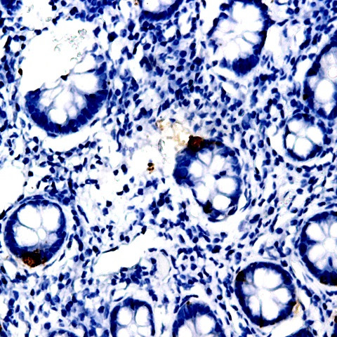 Osteopontin Antibody in Immunohistochemistry (Paraffin) (IHC (P))