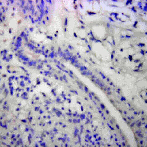 Bak Antibody in Immunohistochemistry (Paraffin) (IHC (P))