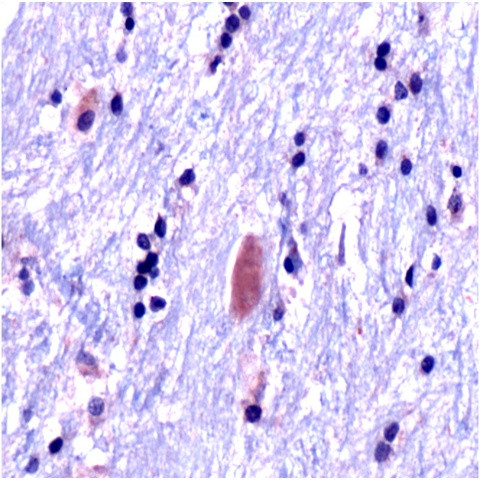 Ubiquitin Antibody in Immunohistochemistry (Paraffin) (IHC (P))