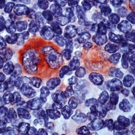 Bcl-X Antibody in Immunohistochemistry (PFA fixed) (IHC (PFA))