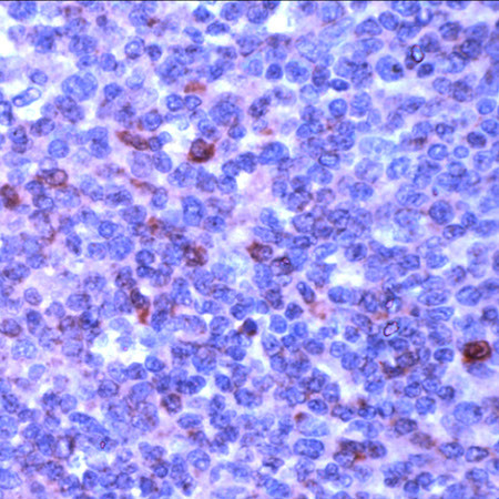 BAX Antibody in Immunohistochemistry (PFA fixed) (IHC (PFA))