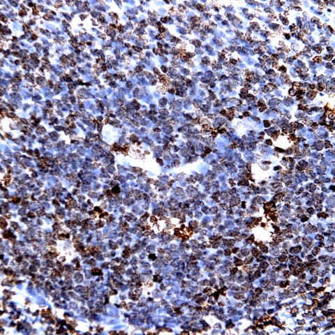 CD99 Antibody in Immunohistochemistry (Paraffin) (IHC (P))