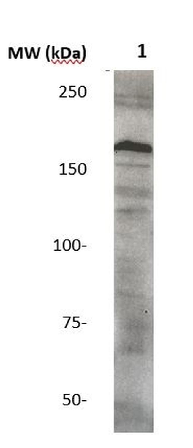 c-erbB3 Antibody in Western Blot (WB)