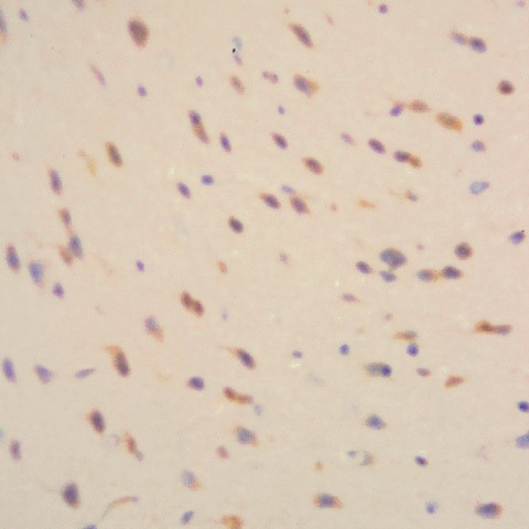 Amyloid beta Antibody in Immunohistochemistry (Paraffin) (IHC (P))