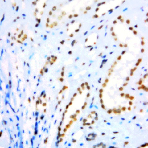 Cyclin E Antibody in Immunohistochemistry (Paraffin) (IHC (P))