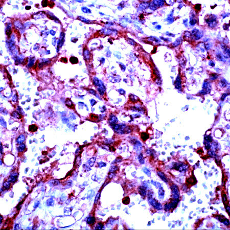 MMP-9 Antibody in Immunohistochemistry (Paraffin) (IHC (P))