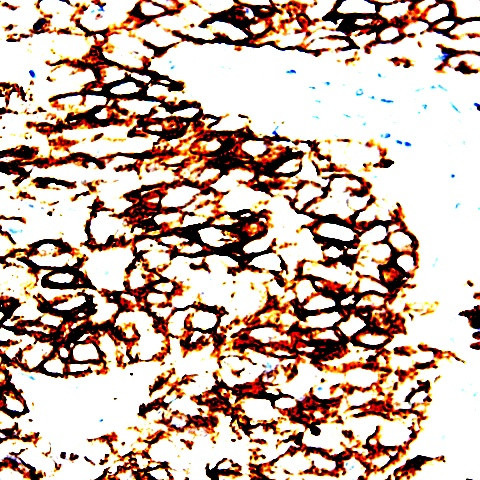 Catenin gamma Antibody in Immunohistochemistry (Paraffin) (IHC (P))