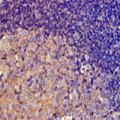 CD40 Antibody in Immunohistochemistry (Paraffin) (IHC (P))