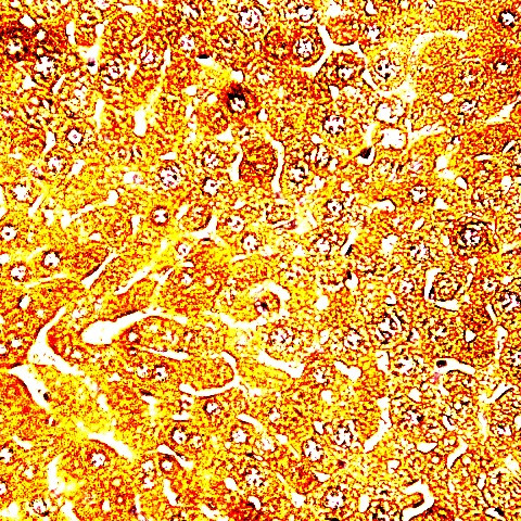 a-B-Crystallin Antibody in Immunohistochemistry (Paraffin) (IHC (P))