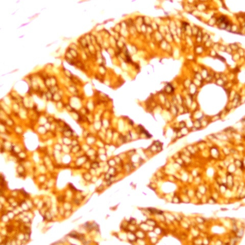 Claudin 3 Antibody in Immunohistochemistry (Paraffin) (IHC (P))