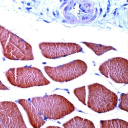 Actin, Skeletal Muscle Antibody in Immunohistochemistry (Paraffin) (IHC (P))