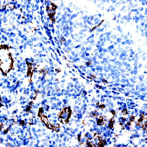 PDGF-A Antibody in Immunohistochemistry (Paraffin) (IHC (P))