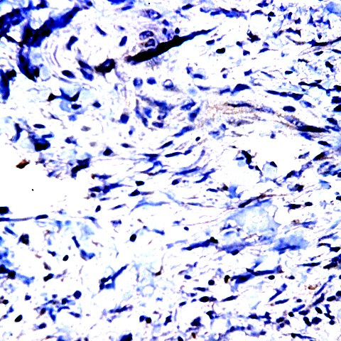 MMP-23 Antibody in Immunohistochemistry (Paraffin) (IHC (P))
