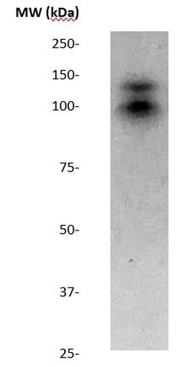 Somatostatin Receptor 1 Antibody in Western Blot (WB)