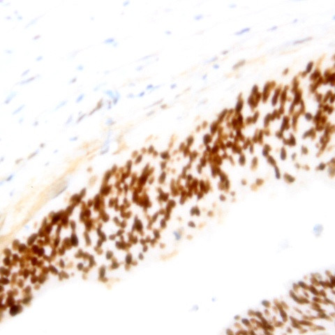 Cyclin B1 Antibody in Immunohistochemistry (Paraffin) (IHC (P))