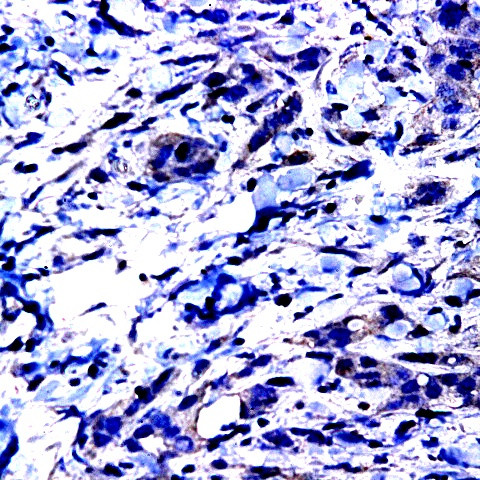 MMP-15 Antibody in Immunohistochemistry (Paraffin) (IHC (P))