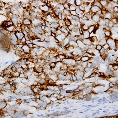 Tubulin alpha Antibody in Immunohistochemistry (Paraffin) (IHC (P))