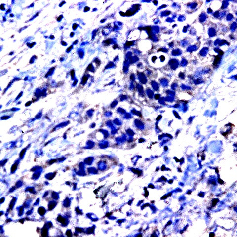 CD105 Antibody in Immunohistochemistry (Paraffin) (IHC (P))