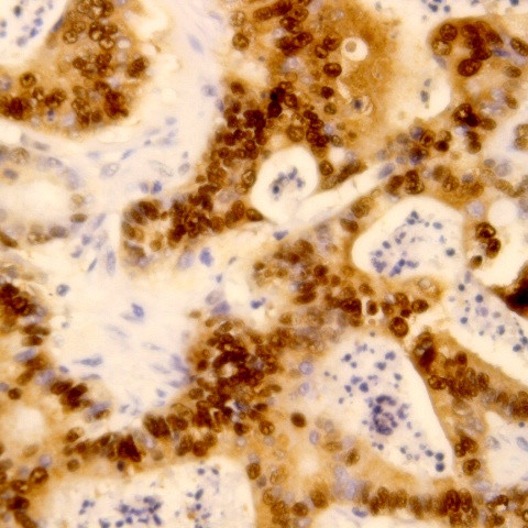 Retinoblastoma (RB) Antibody in Immunohistochemistry (Paraffin) (IHC (P))