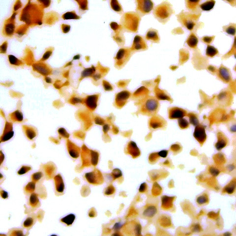 p14ARF Antibody in Immunocytochemistry (ICC/IF)