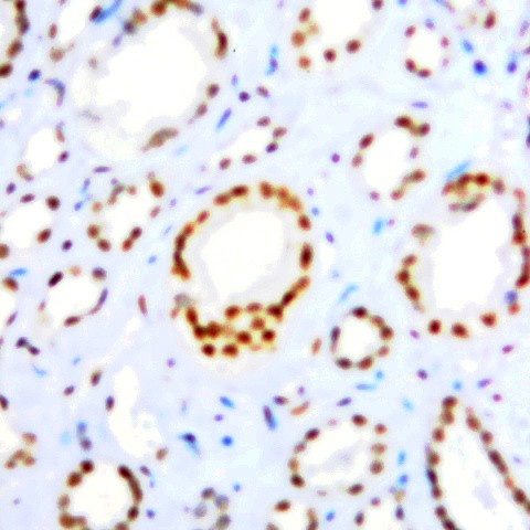 c-fos Antibody in Immunohistochemistry (Paraffin) (IHC (P))