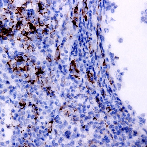 IFN gamma Antibody in Immunohistochemistry (Paraffin) (IHC (P))