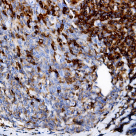CD34 Antibody in Immunohistochemistry (Paraffin) (IHC (P))