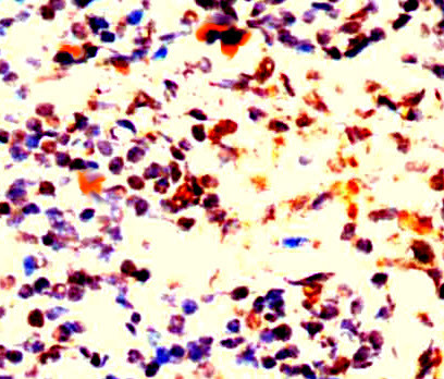 BCL-2 Antibody in Immunohistochemistry (Paraffin) (IHC (P))