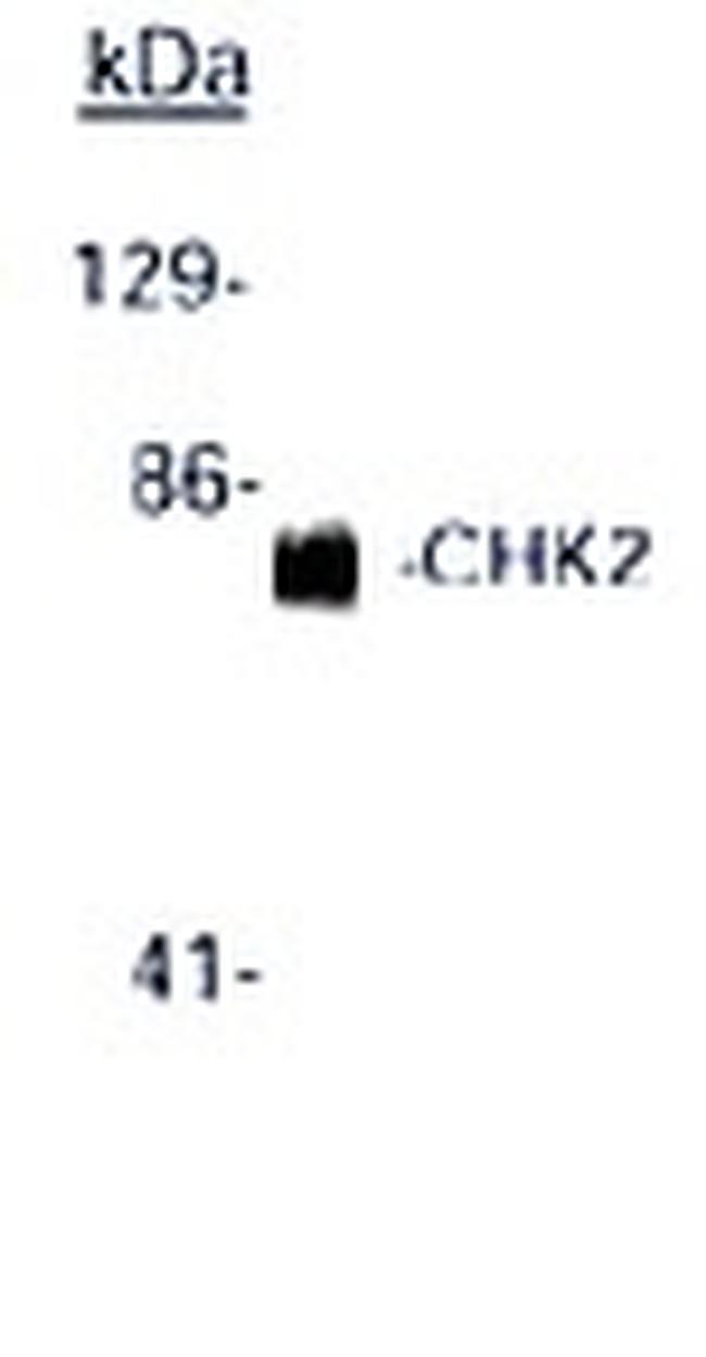 Chk2 Antibody in Western Blot (WB)