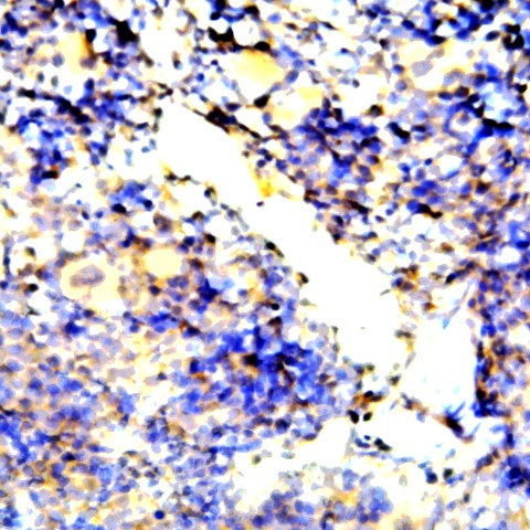 Endostatin Antibody in Immunohistochemistry (Paraffin) (IHC (P))
